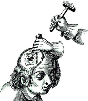 Chisel Use on Cranium, Scultetus