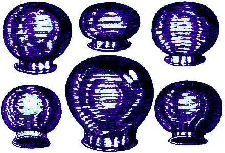 Different Sized Cupping Glasses