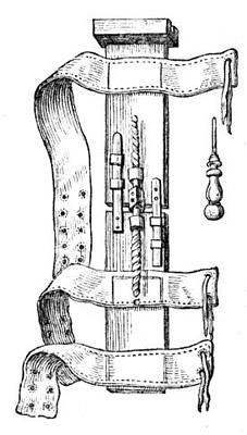 Fracture Extension Device Created by William Fabry