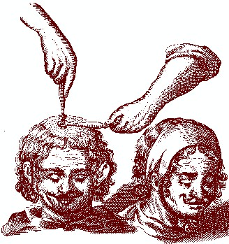 Making a Head Fontanel