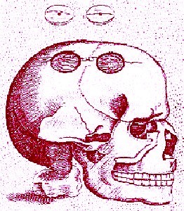 Trepanned Skull, Scultetus