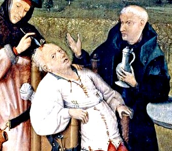 Trepanning Operation