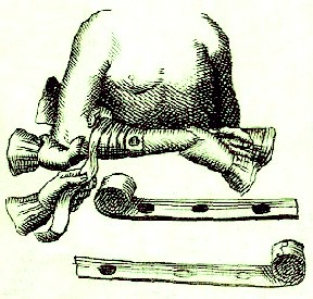 Dressing an Arm Fracture