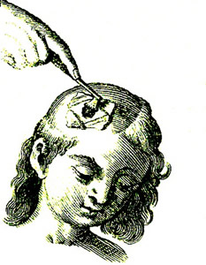 Rasping, Scultetus