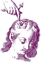 Trefine Use