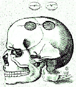 Trepanned Skull