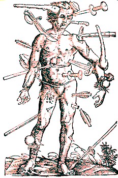 Wound Man